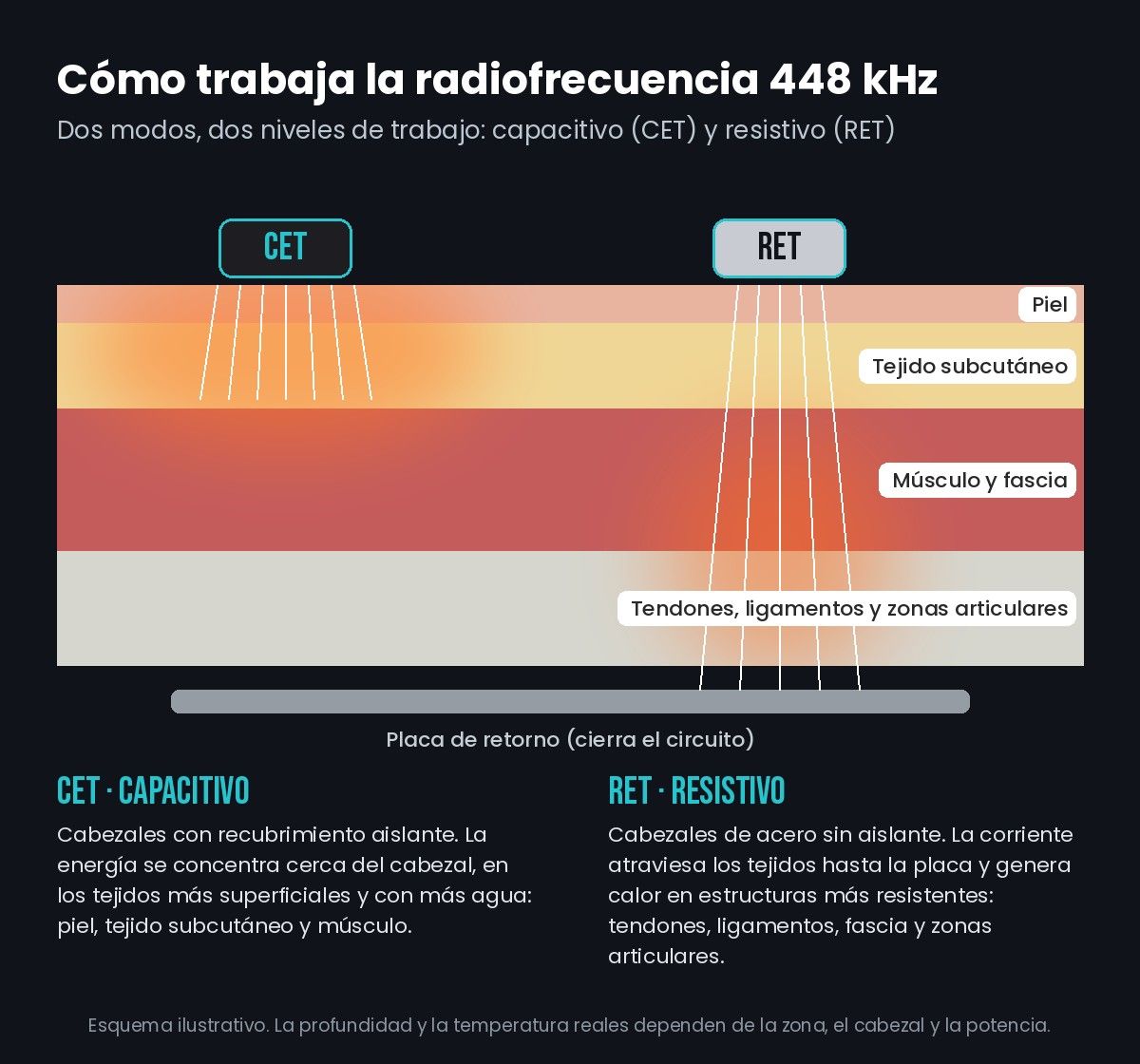Esquema de radiofrecuencia capacitiva y resistiva sobre las capas de tejido